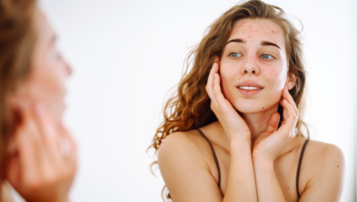 Pelle arrossata dal freddo? I rimedi dermatologici utili