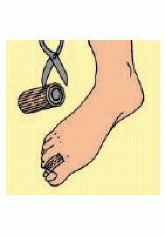 S109MF DIGI-STRIP TUB C/GEL M