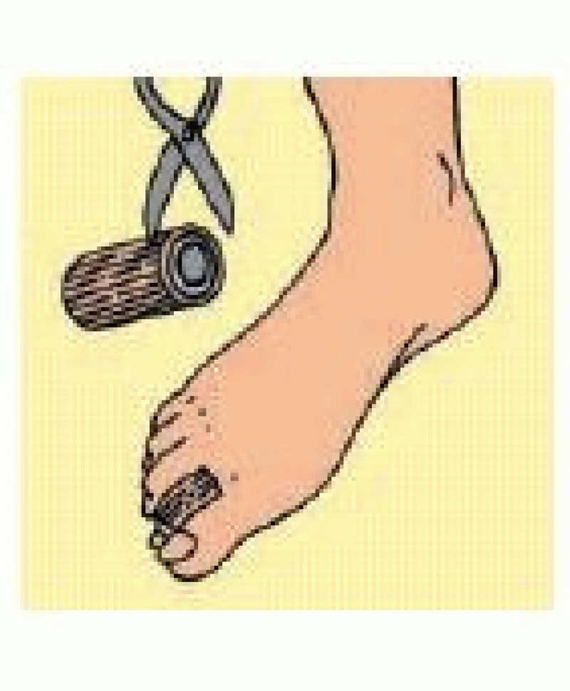 S109SF DIGI-STRIP TUB C/GEL S