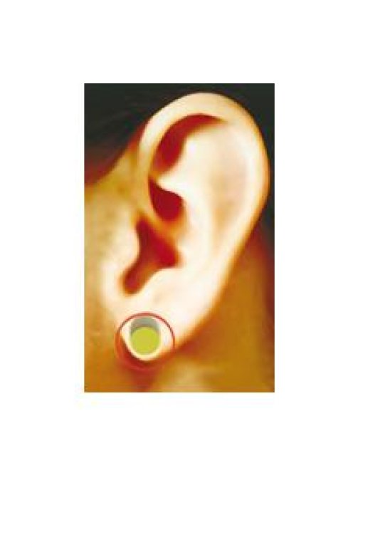 MENOSTRESS AURICOLOTERAPIA MAG