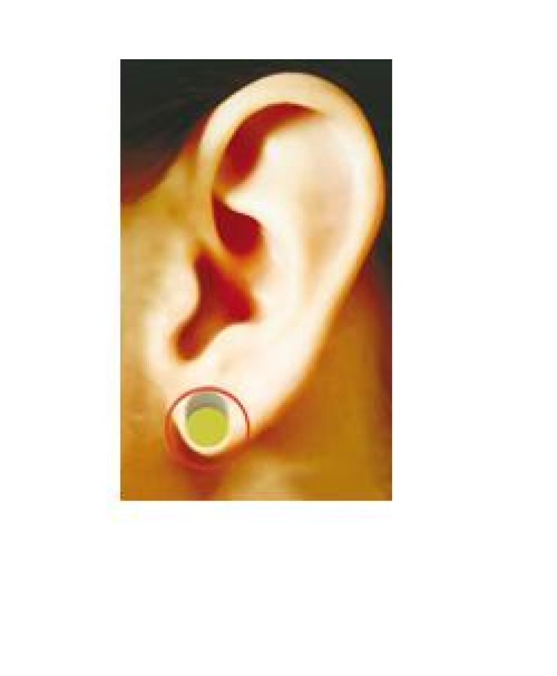 MENOSTRESS AURICOLOTERAPIA MAG