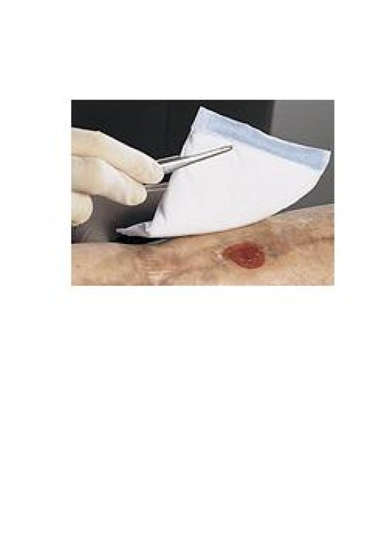 VLIWAZELL N/STER 10X20CM 25PZ