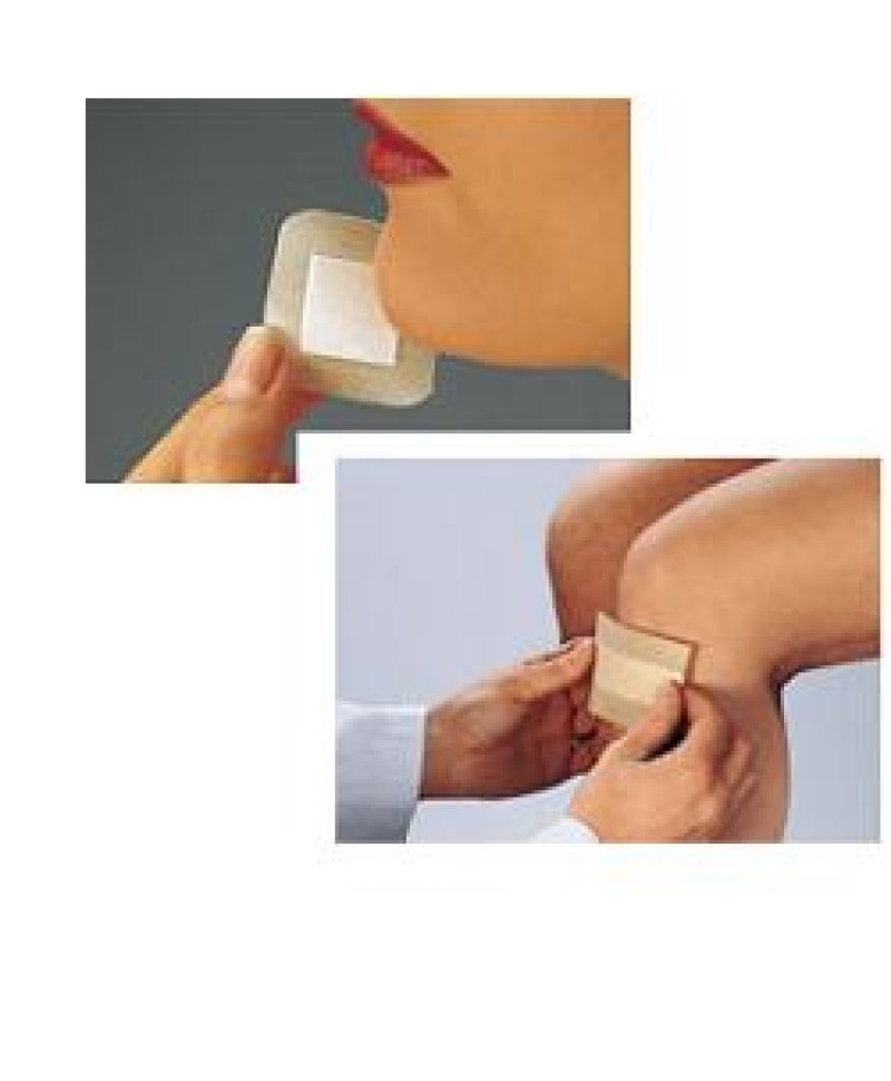 CURAPLAST SENSITIVE STR 8X10CM