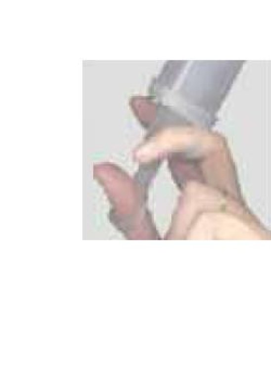 SCHIZZETTONE PLASTICA 100ML