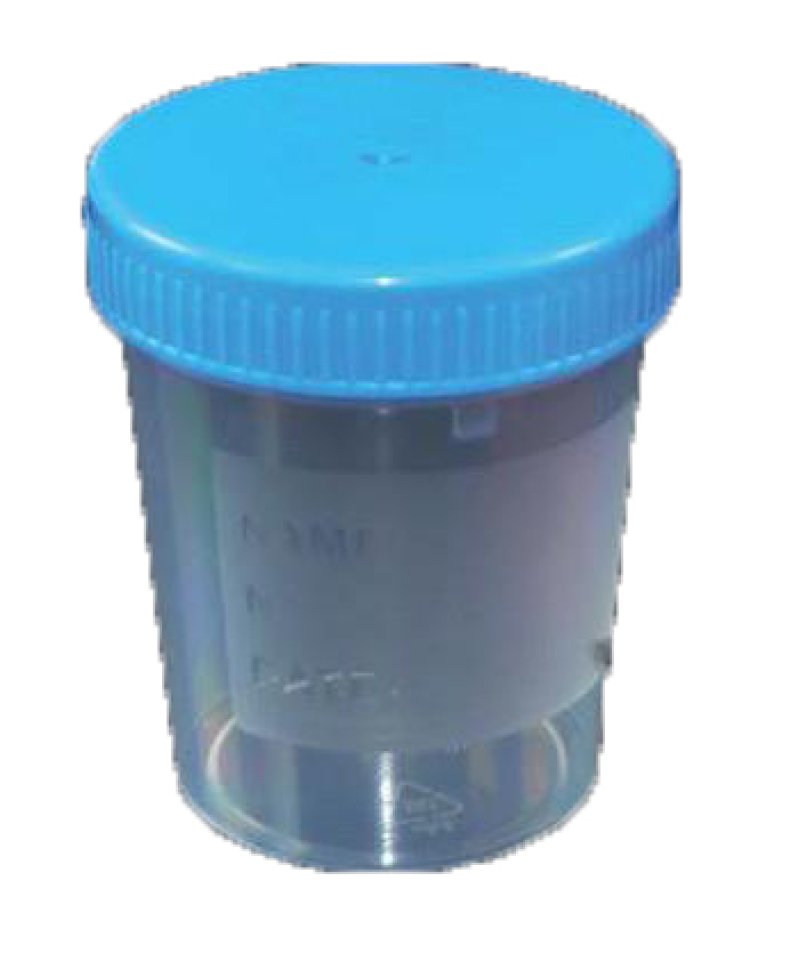 CONTENITORE URINE ASETTICO 120ML